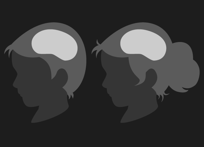 Child Brain Profiles